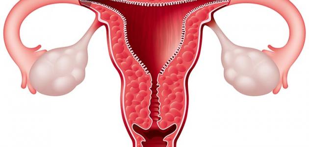 علاج ضعف المبايض , اشعر بالم شديد اسفل البطن