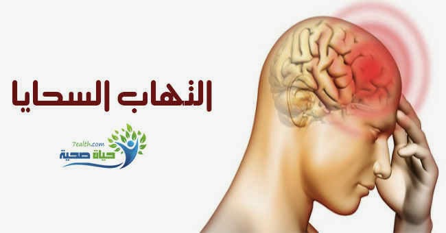 مرض السحايا - علاج مرض السحايا باسرع وقت 2516 3