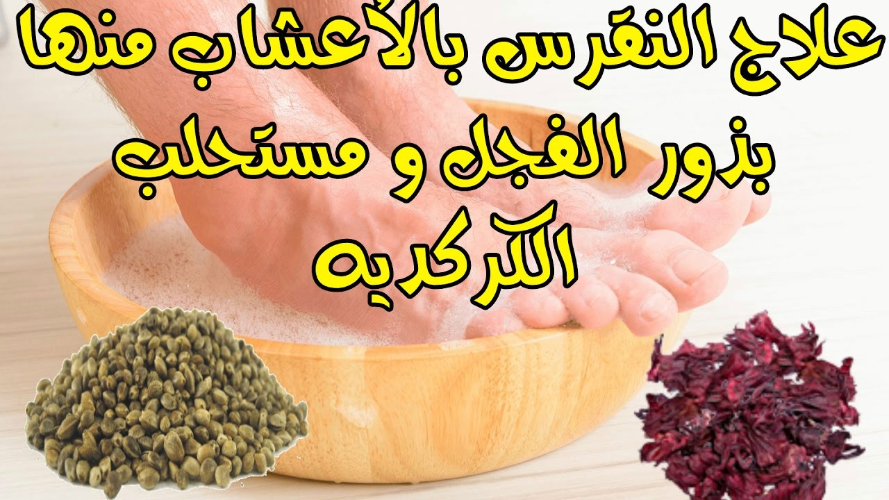 علاج النقرس , التخلص من مرض النقرس بطرق منزليه