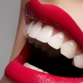 4420 4 كيفية تبييض الاسنان - طرق سهله لتبييض الاسنان فياض مرادي