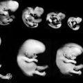 381 12 مراحل تكوين الجنين بالصور من اول يوم - عرض مفصل لتكوين الجنين نغم