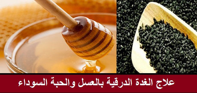11593 1 علاج الغدة الدرقية بالعسل والحبة السوداء - وصفة طبيعية للغدة الطاف منصور