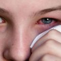 11063 2 نصائح لحماية العين - علاج حكة العين بركة حاسم