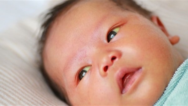 لماذا تصفر عين طفلك , اسباب اصفرار العين عند الاطفال - اقتباسات